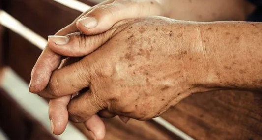 Pecas, ¿o manchas de aceite de semillas?