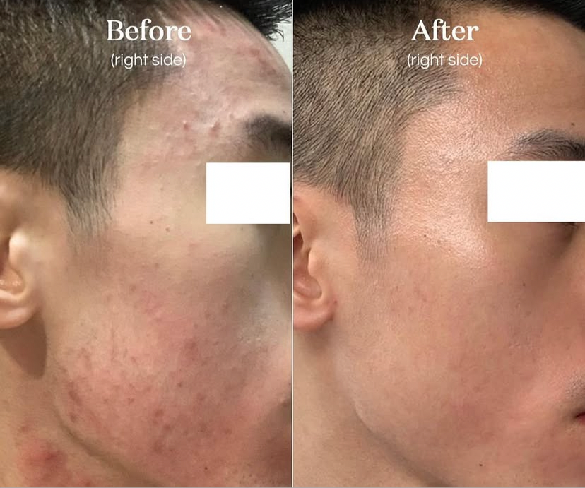 Deep Face Reset - Protocolo de regeneración facial · Quito, Ecuador