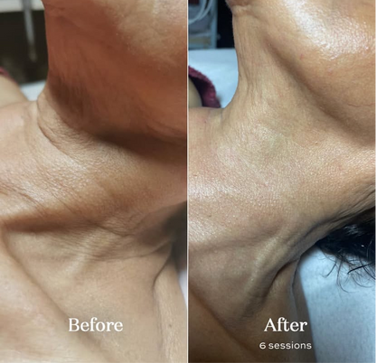 Deep Face Reset - Protocolo de regeneración facial · Quito, Ecuador