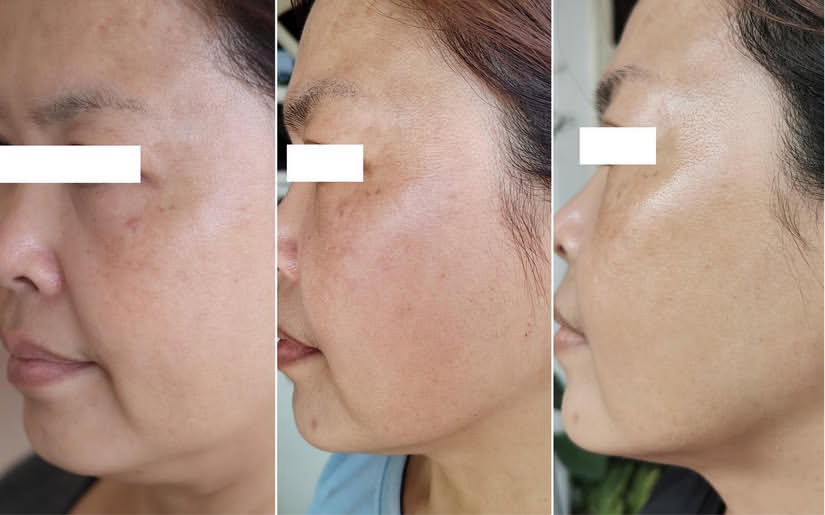 Deep Face Reset - Protocolo de regeneración facial · Quito, Ecuador