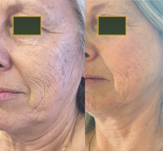 Deep Face Reset - Protocolo de regeneración facial · Quito, Ecuador