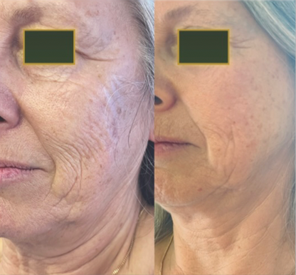 Deep Face Reset - Protocolo de regeneración facial · Quito, Ecuador
