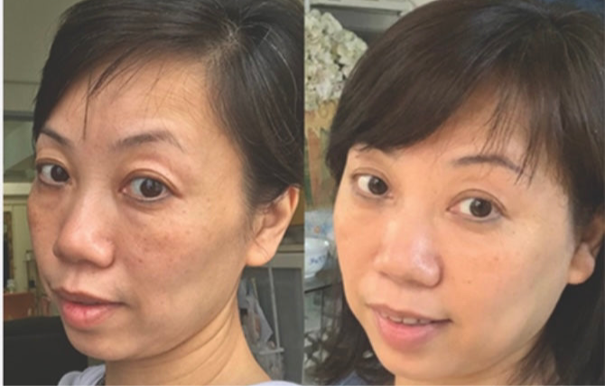 Deep Face Reset - Protocolo de regeneración facial · Quito, Ecuador