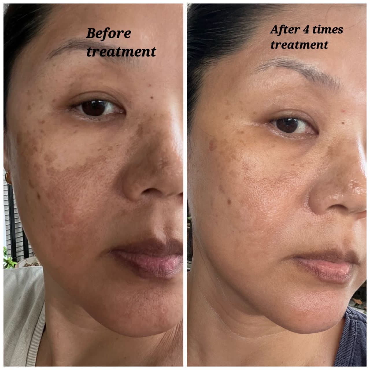 Deep Face Reset - Protocolo de regeneración facial · Quito, Ecuador
