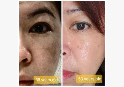 Deep Face Reset - Protocolo de regeneración facial · Quito, Ecuador